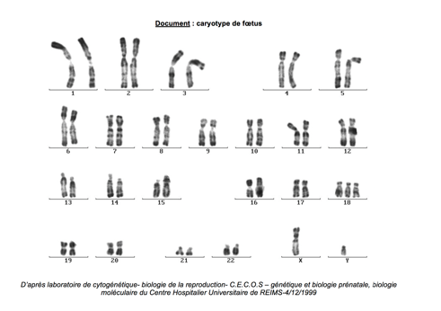 Caryotype de foetus – Innover en SVT